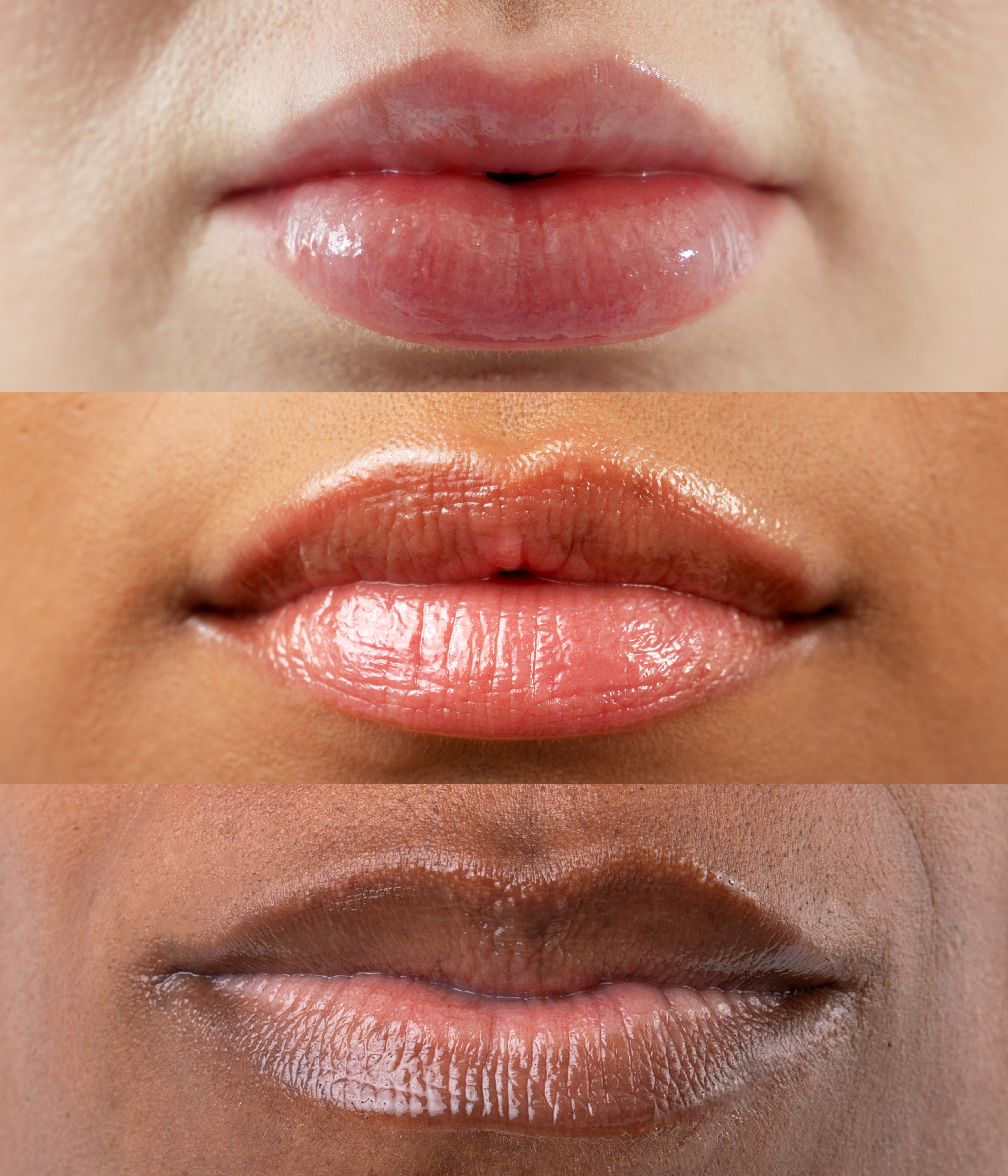 Glycolide Lipid Repair