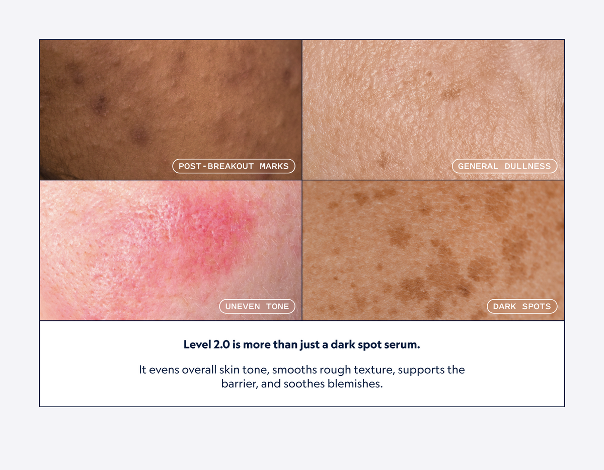 Level Serum