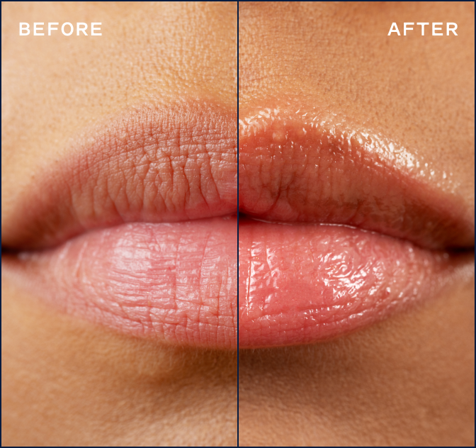D   Product Image   Hover   Glycolide Lipid Repair